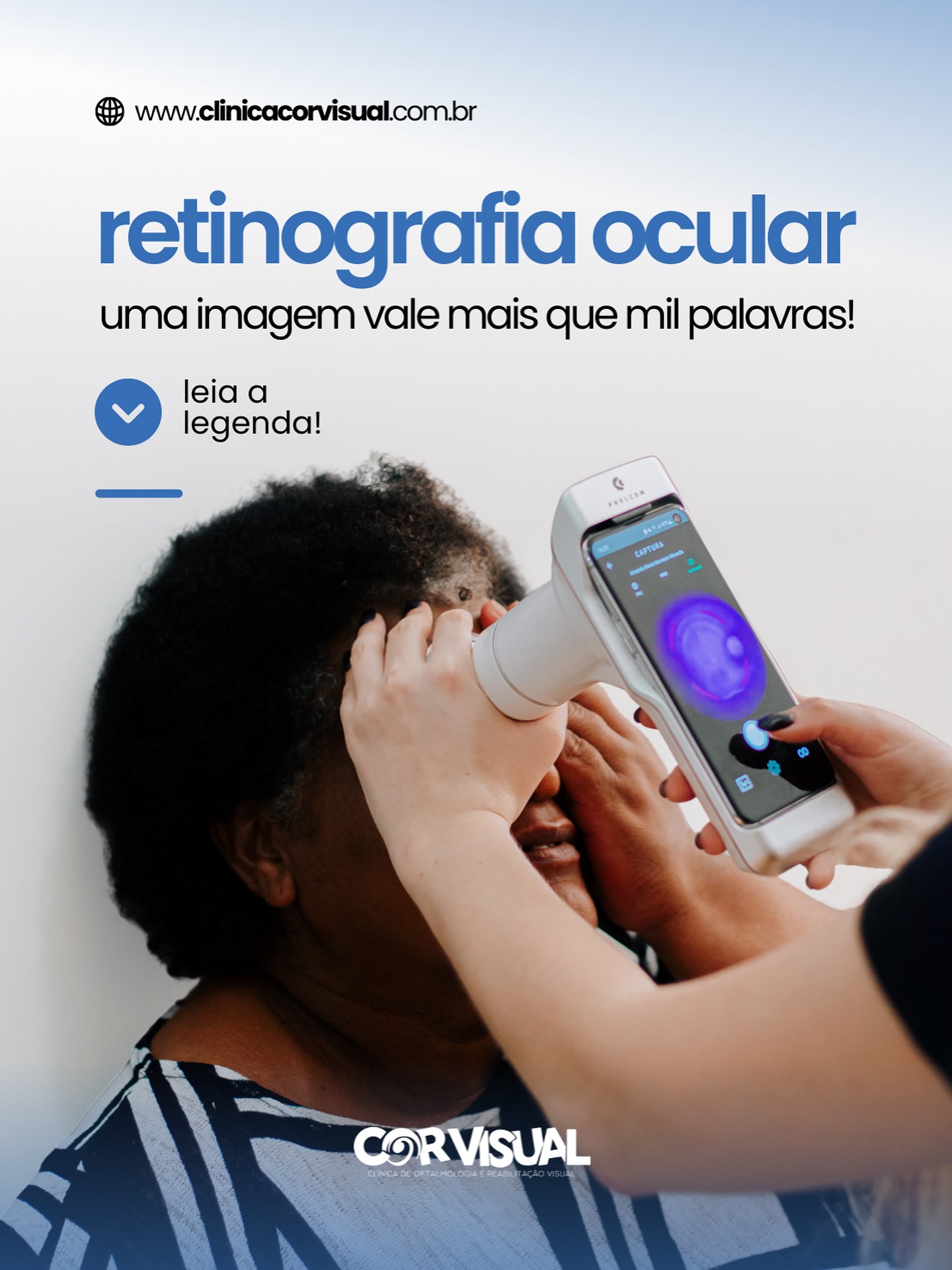 A Retinografia é um exame de imagem que fotografa o fundo do olho, retina, nervo óptico e vasos sanguíneos.Rápido e indolor, é essencial para detectar alterações que podem comprometer a visão, muitas vezes antes dos sintomas aparecerem! 👁️
🔬 O que o exame analisa? Imagens de alta resolução permitem observar:
- A retina, que capta a luz e envia sinais ao cérebro.
- O nervo óptico, responsável pela transmissão dessas informações.
- Os vasos sanguíneos, que revelam sinais de doenças como diabetes e hipertensão.
- A mácula, que garante a visão de detalhes e cores.
⚠️ Doenças detectáveis:
- Retinopatia diabética
- Degeneração macular (DMRI)
- Glaucoma
- Hipertensão ocular
- Oclusões venosas ou arteriais
✅ Benefícios:
- Prevenção precoce
- Monitoramento evolutivo
- Exame seguro e confortável
- Apoio ao diagnóstico oftalmológico e sistêmico
📍 Aqui na Clínica Cor Visual, contamos com equipamentos modernos e equipe especializada para realizar sua retinografia com excelência e cuidado.
📅 Agende seu exame e cuide da sua visão com quem entende do assunto.
📞 (83) 3322.3590 / (83) 3063.3590
📲 WhatsApp (83) 99612.0813
-
Marketing e Produção Audiovisual: @Kactus.Agencia 🌵
#campinagrande #joaopessoa #paraiba #oftalmologista #oftalmologiapediatrica #oftalmologia #oftalmologistainfantil #clinicaoftalmologica #oftalmologistacampinagrande #oftalmologistacg #oftalmologistaparaiba #clinicadeoftalmologia #saudedosolhos #saudeinfantil #clinicacorvisual #corvisual #catarata #cirurigiadecatarata #lentesdecontato #lentedecontato #lentedecontatocampinagrande #RetinografiaOcular #Retinografia
